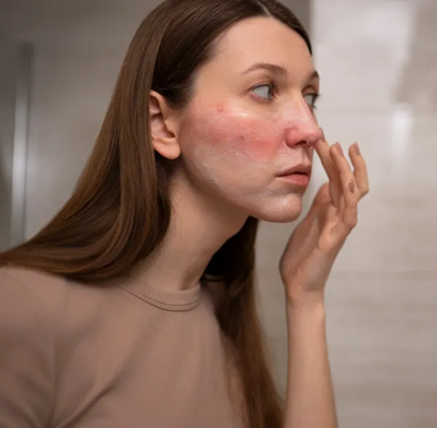 Como saber se tem pele sensível: os sinais que não pode ignorar!