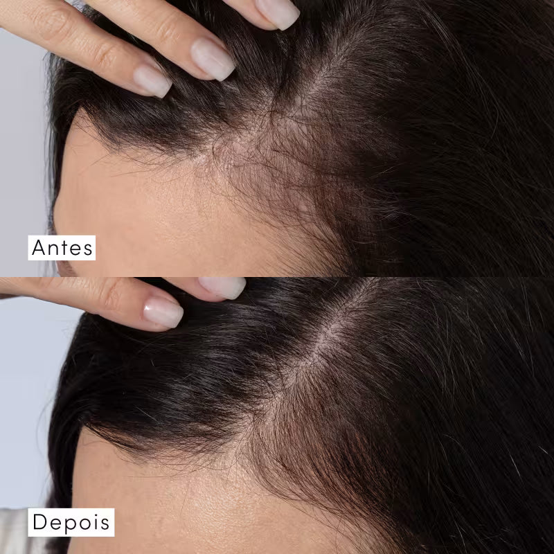 Eudora Siàge Dermo Hair Shampoo Resistência Antiqueda 300ml